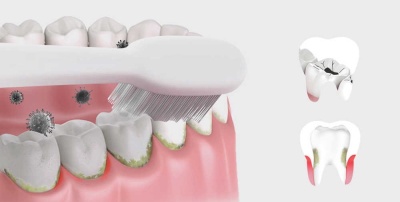 фото Беспроводной ирригатор Xiaomi Zhibai XL1